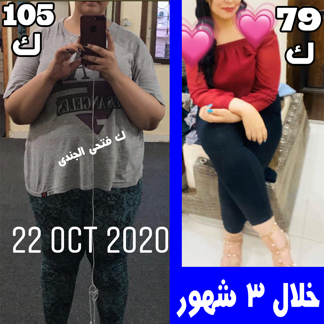 وعد — نتيجة قبل وبعد خسارة ٢٦ كجم بدون ترهلات