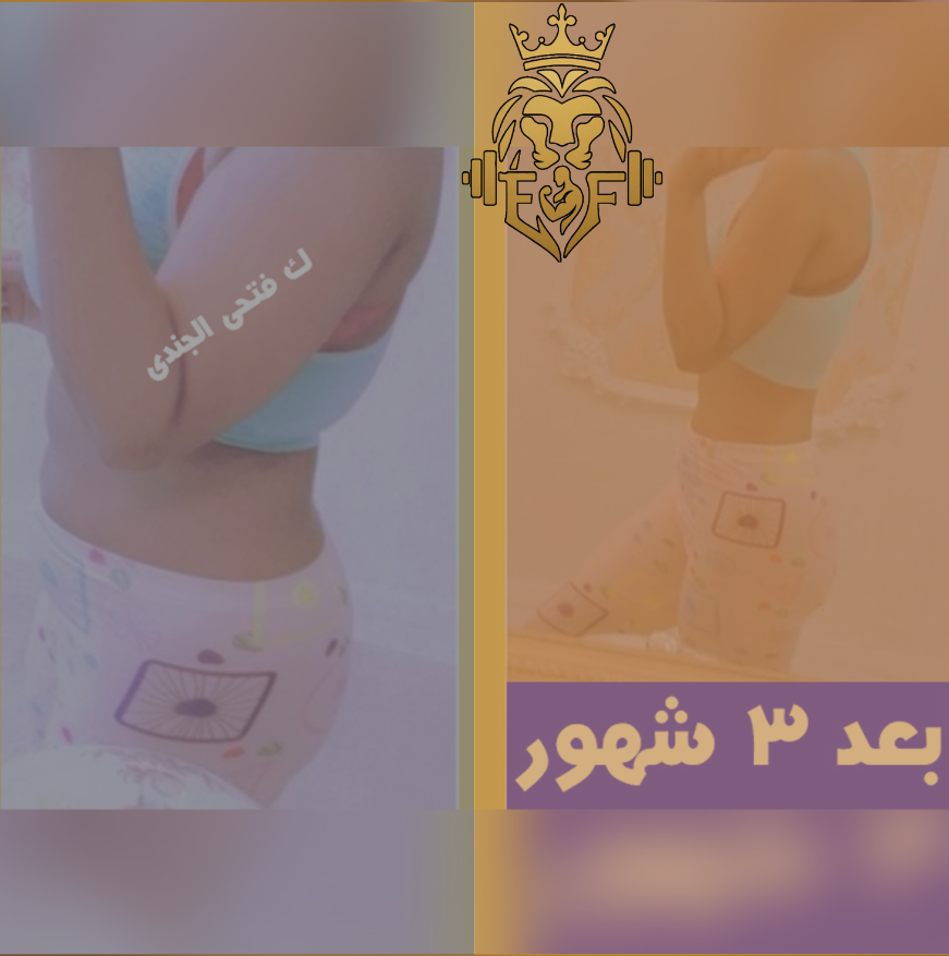 سماهر — نتيجة قبل وبعد خسارة ٤٠ كجم مع شد الجسم