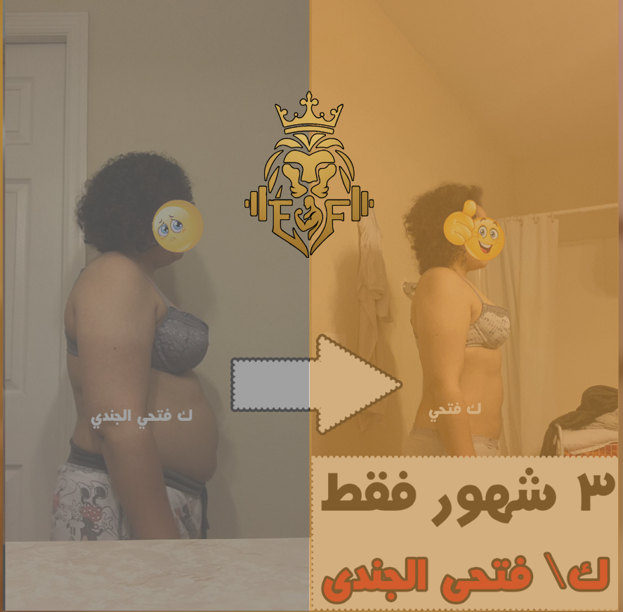 أسماء — نتيجة قبل وبعد خسارة ٢٥ كجم رغم إصابة الظهر